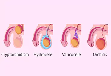 prostate